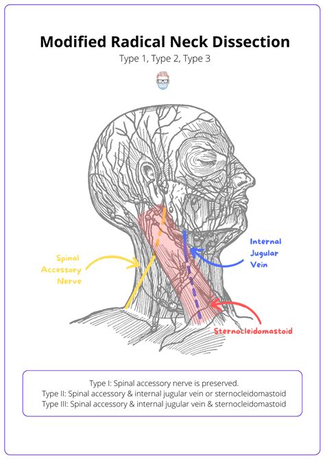 Neck Dissection · Types, Anatomy, Indications, Complications