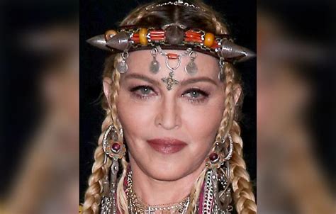 Madonna's Shocking Plastic Surgery Makeover Exposed By Top Docs