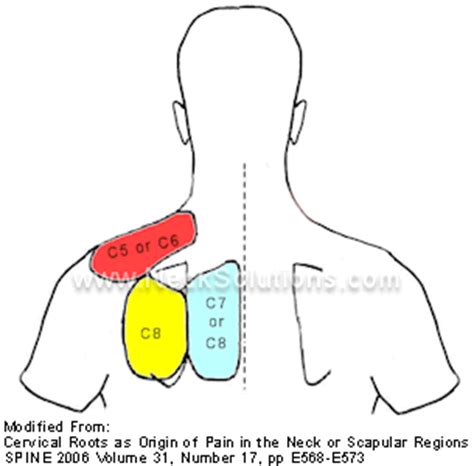 Pinched Nerve In Arm Symptoms