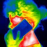 (a) Visualization of thermal effects in a human head before use of a... | Download Scientific ...