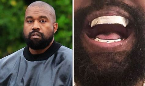 Kanye West has Bond villain transformation with metal teeth that cost 'more than diamonds ...