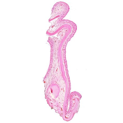 Human Elastic cartilage section, or say yellow cartilage prepared ...