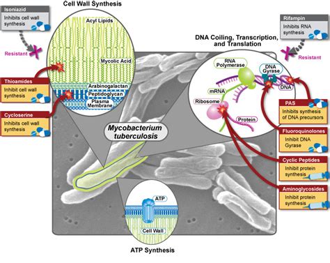 Multidrug-Resistant Tuberculosis (MDR-TB) - Dream Health