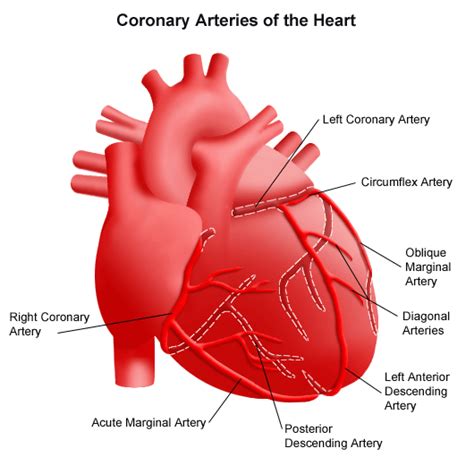 Coronary Artery Disease | Stanford Health Care