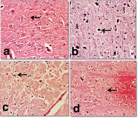 Substantia Nigra Histology