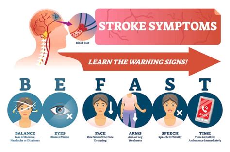 Examining the 2021 Guidelines: Stroke Prevention | Becky Dorner