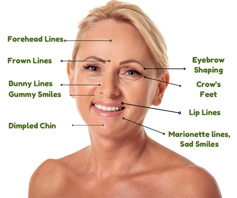 8 Types of Wrinkles Smoothed by BOTOX® Cosmetic & Dermal Fillers ...