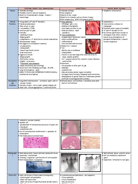 Central Giant Cell Granuloma | Bone | Neoplasms