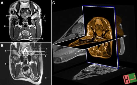 MR images of the brain at the level of pons in transversal plane. A ...