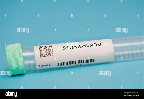 Salivary Amylase Test This test measures the levels of amylase, an enzyme produced by the ...