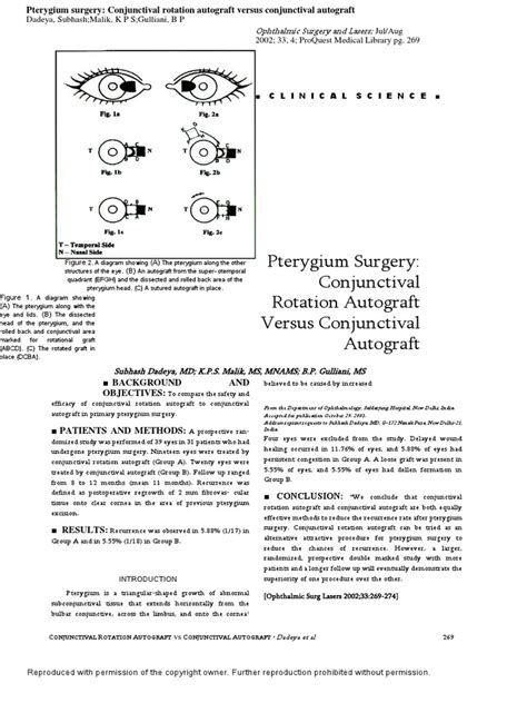 Pterygium Surgery | Surgery | Health Sciences