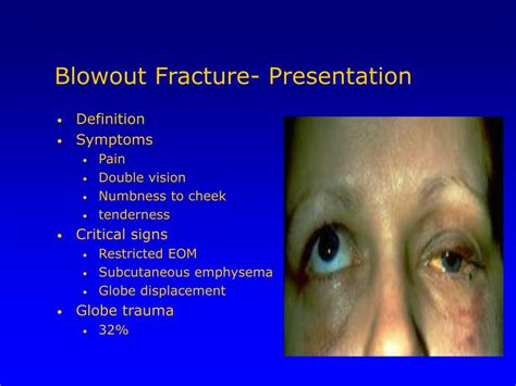 PPT - Orbital Trauma PowerPoint Presentation, free download - ID:1278840