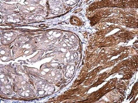 CD146 Antibody (PA5-28893)