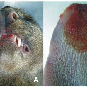 Severe cowpox lesion on the patient’s chin caused by the identical ...