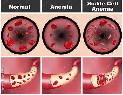 Red Blood Cell 3d Cgtrader