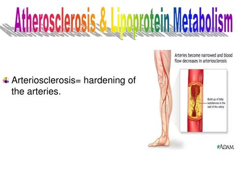 PPT - Arteriosclerosis= hardening of the arteries. PowerPoint ...