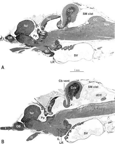 Brain histology of Dolloidraco longedorsalis (longitudinal sections).... | Download Scientific ...