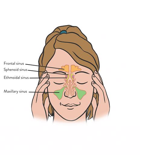 Anatomy Of Sinus Infection