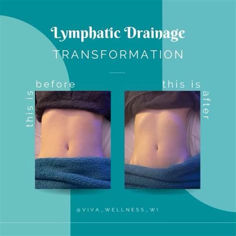 Can Lymphatic Drainage Treatment help me lose weight? | VIVA Wellness