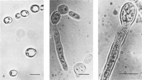 Dar a luz Leonardoda más candida albicans microscope apasionado Señor Hay una tendencia