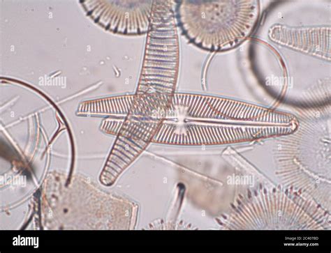 Diatomaceae, Diatoms from Alaska, microscope view Stock Photo - Alamy