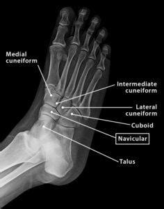 Navicular Bone - Location, Anatomy, & Labeled Diagram