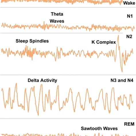 Specific EEG characteristics of different sleep stages | Download Scientific Diagram