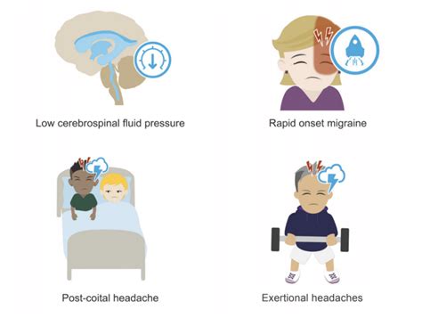 Thunderclap headache • LITFL • Neurology library