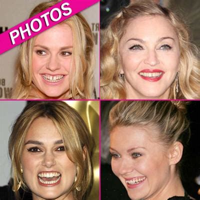 Celebrity Imperfections! 10 Stars With Not So Terrific Teeth