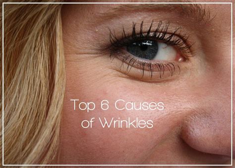 top 6 causes of wrinkles