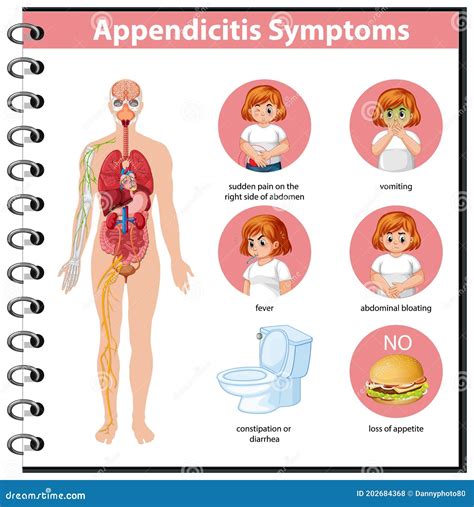 Appendicitis Symptoms 6 Classic Signs And Symptoms Of Appendicitis Page ...