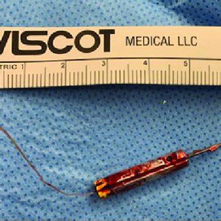 Clinical photograph showing the impaled probe with TASER wire. a ...