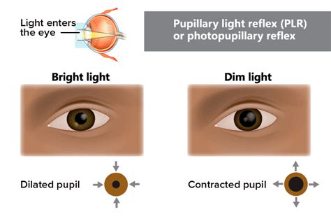 Dilated Pupils (Mydriasis): What Is It, Causes What It, 40% OFF