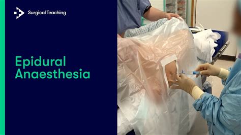 Epidural Anaesthesia: What is it and How Do We Perform it? - YouTube