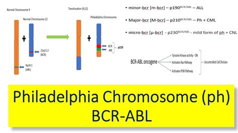 Philadelphia Chromosome [Ph] – Introduction, variants of BCR ABL gene fusion & Effects of ...