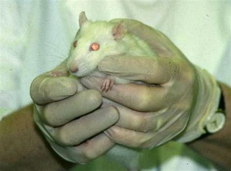 Rat Bite Fever | Media of human drug-disease information