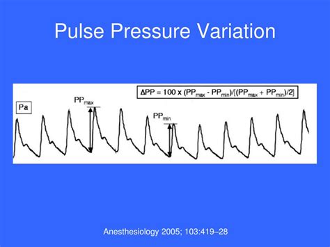 PPT - Monitoring Fluid Responsiveness PowerPoint Presentation, free download - ID:1370702