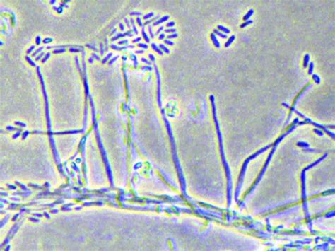 Acremonium | Mycology | University of Adelaide