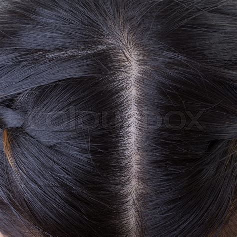 Black hair with dandruff on head, ... | Stock image | Colourbox