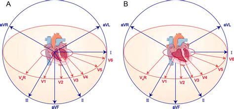 A Schematic illustration of the relationship between normal electrical... | Download Scientific ...