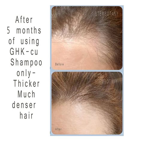 Alopecia Treatment | Copper Peptide Conditioner | Ghk-Cu Conditioner