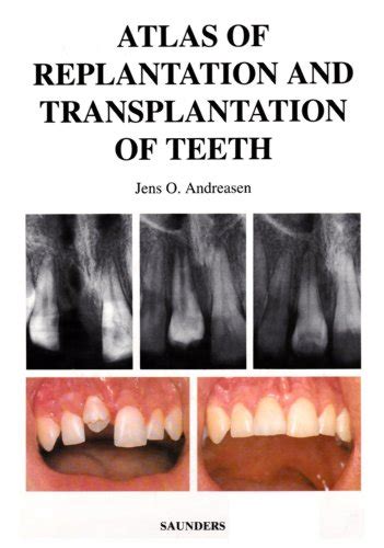 『Atlas of Replantation and Transplantation of Teeth』｜感想・レビュー - 読書メーター