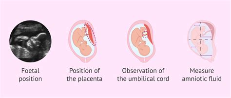 Fetal ultrasound in the third trimester of pregnancy