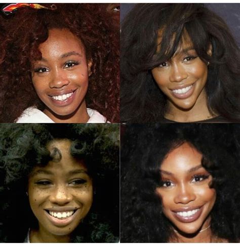 Sza Before And After Plastic Surgery: Everything You Need To Know!