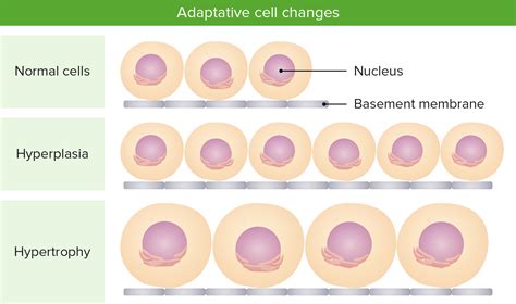 Cellular Adaptation | Concise Medical Knowledge