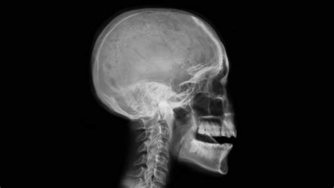 Head X-ray - Various Moves. Stock Footage Video (100% Royalty-free) 6390320 | Shutterstock