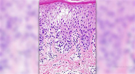 Prevention of bovine spongiform encephalopathy | General center ...