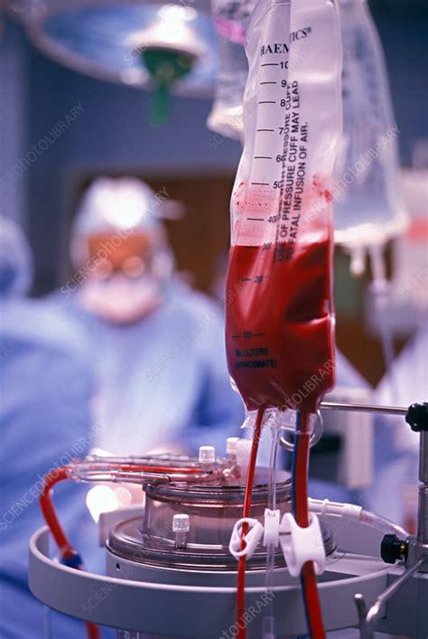 Blood Transfusion - Stock Image - M580/0298 - Science Photo Library