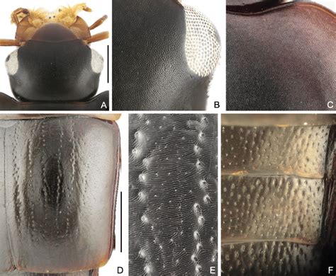 Morphology of Olophrinus qian sp. nov., male, showing microsculpture of ...