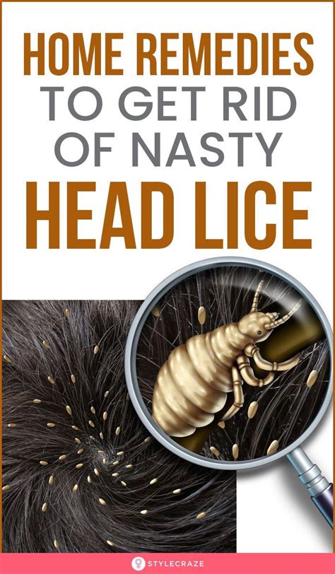 How Do You Get Rid Of Head Lice: Remedies, Treatments, Prevention ...